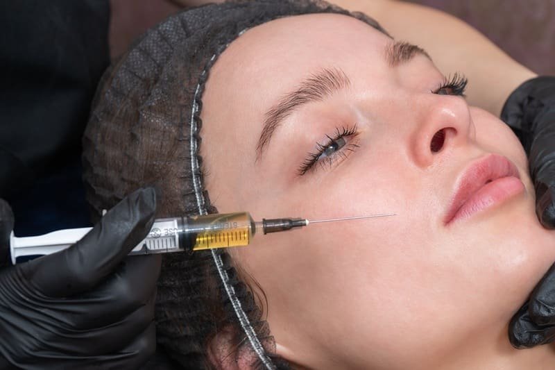 Bioestimulación Facial con Plasma Rico en Plaquetas