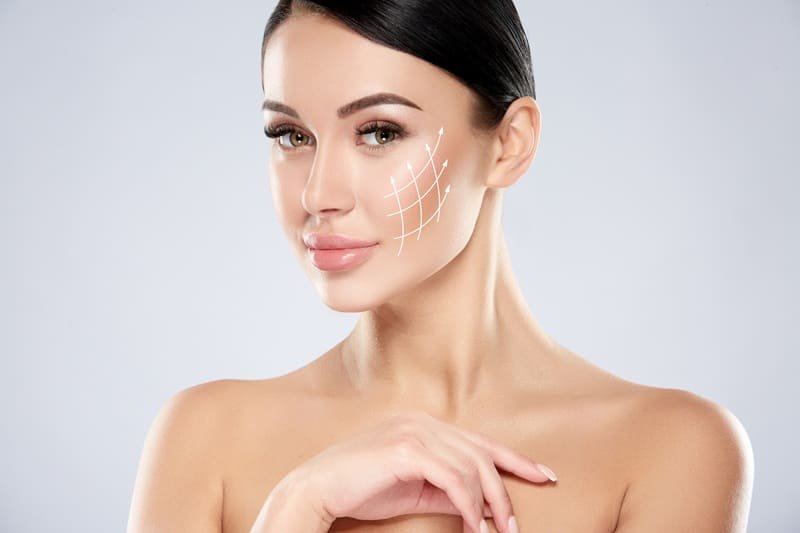 Hilos de Dermosustentación Facial